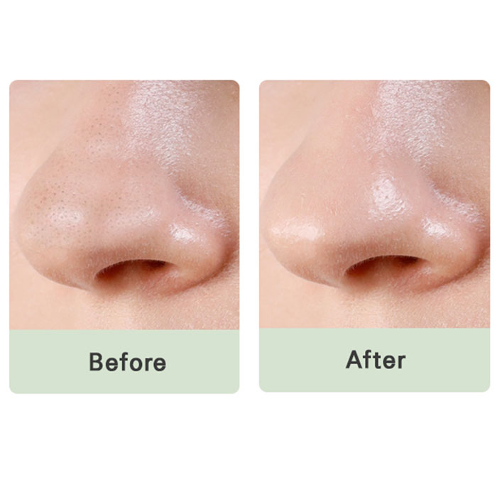 Mizon Pore Fresh Clear Nose Pack
