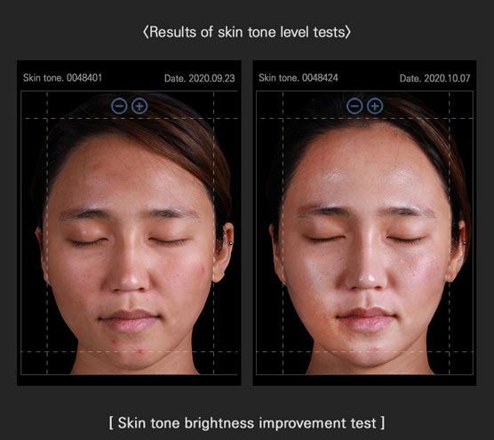 Real Vitamin C Ampoule Two Faces Before After Image