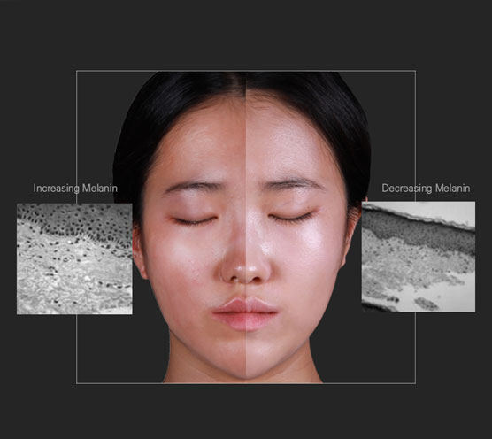 Real Vitamin C Ampoule Face Before After Image