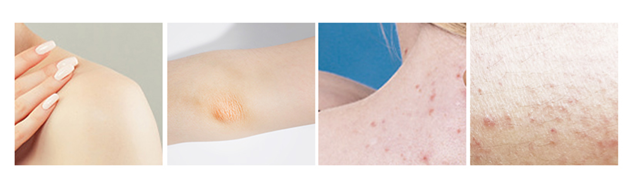 skin conditions image
